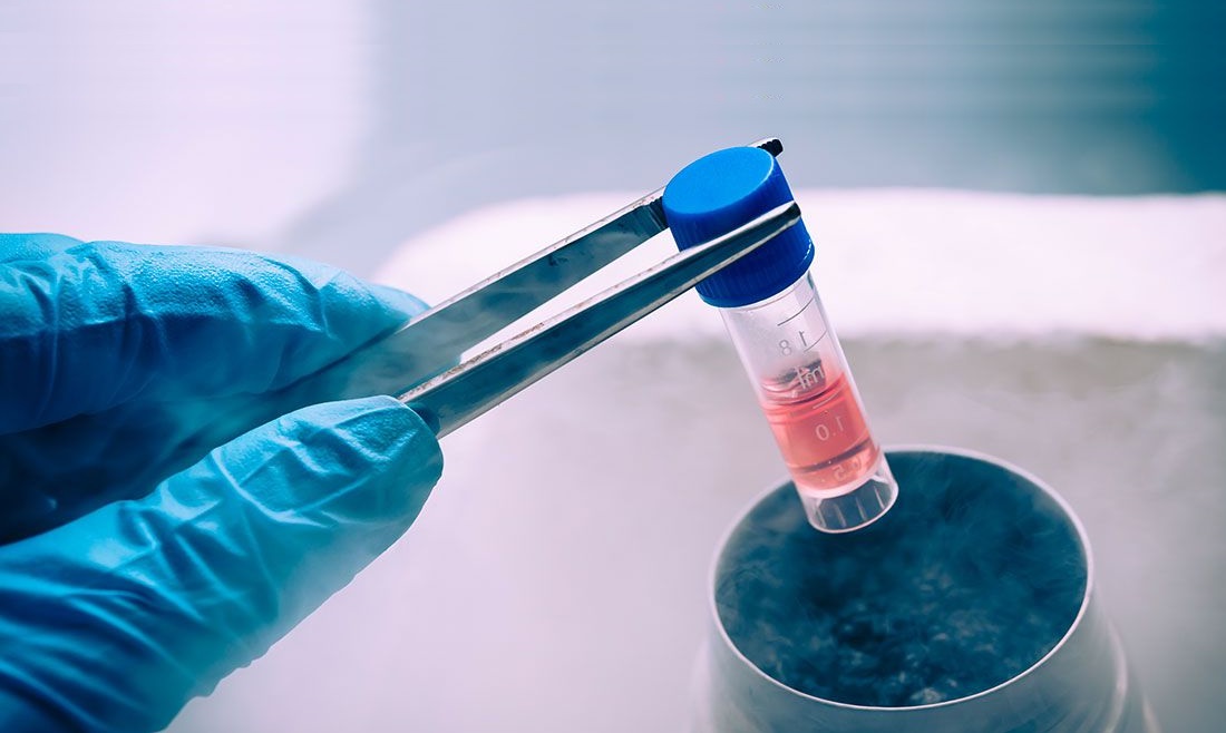 How Cryopreservation helps in successful achievement of parenthood?